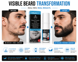Volumon Beard Growth Spray – 60ml, 120ml, or 180ml – Fuller, Thicker Beard Fast – Free UK Delivery