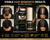 Volumon Hair Regrowth Solution 60ml Spray