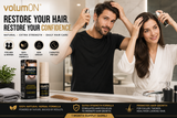 Volumon Hair Regrowth Solution 60ml Spray