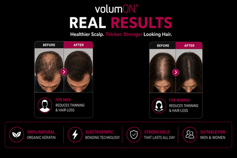 Volumon Hair Building Fibres - KERATIN 28g - For Men & Women!