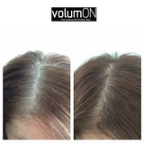 Volumon Hair Loss Concealer and Root Cover Up Kit