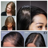 Volumon Hair Loss Concealer and Root Cover Up Kit