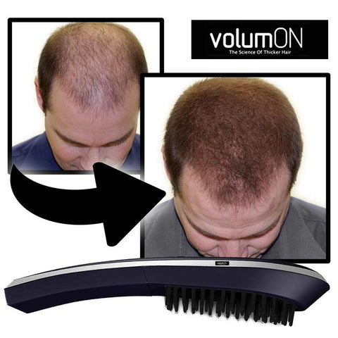 Volumon Laser Massage Comb for Scalp Massage & Hair Growth