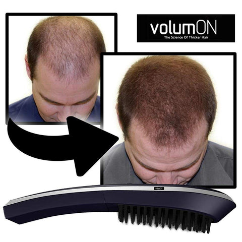 Volumon Laser Massage Comb for Scalp Massage & Hair Growth volumon Volumon Laser Massage Comb for Scalp Massage & Hair Growth volumon