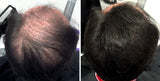Volumon Hair Building Fibres - KERATIN 28g - For Men & Women!