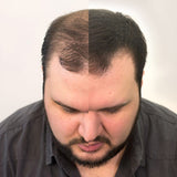Volumon Hair Building Fibres - KERATIN 28g - For Men & Women!
