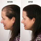 Volumon Hair Loss Hair Building Fibres - Keratin 12g
