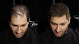 Volumon Hair Building Fibres - KERATIN 28g - For Men & Women!